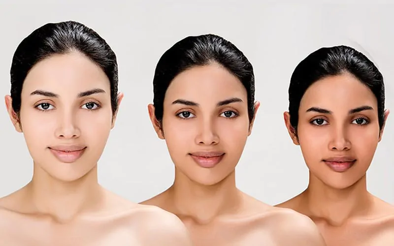 Skin Whitening / Skin Brightening Treatment